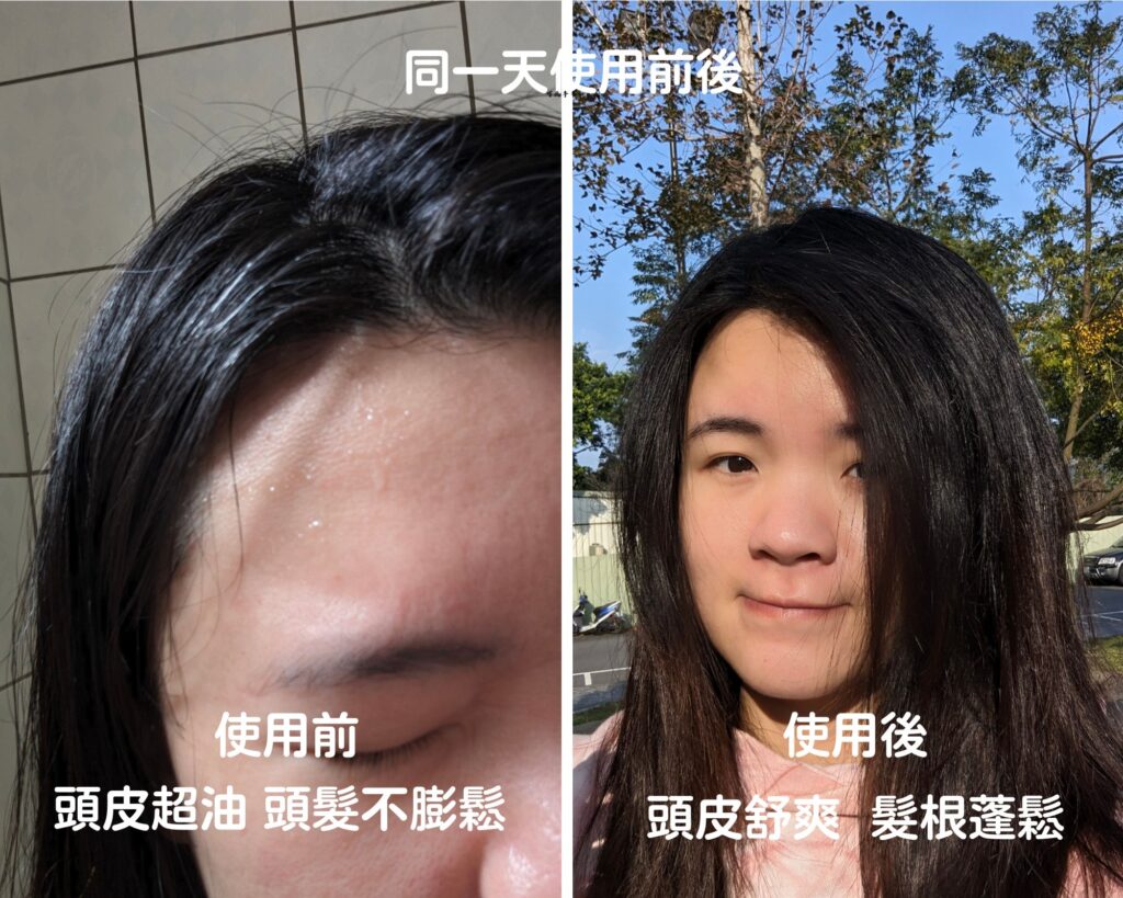 蕨淨森林｜淨化頭皮去角質，幫頭皮做SPA，乾淨又舒爽，圓盾精神頭皮凈化液開箱
