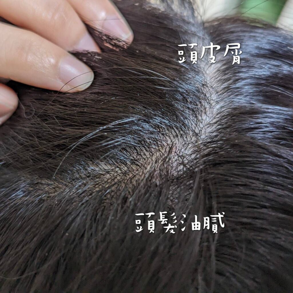 敏感性頭皮洗髮精開箱｜大倉美記OKURA BIKI｜擺脫油膩感，頭皮森呼吸，頭皮滋養產品分享（豐烏育髮精華液＋舒緩淨屑賦活液＋植萃香氛洗髮精－鳶尾花控油）