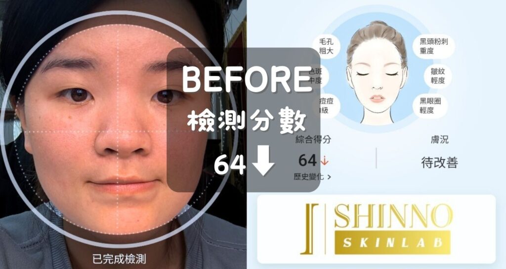 SHINNO評價｜結合科技的保養方式你試過嗎？透過線上AI智能測膚快速了解所需，搭配極潤修護水感面膜與超能白皙光感面膜，讓每週保養更有效！