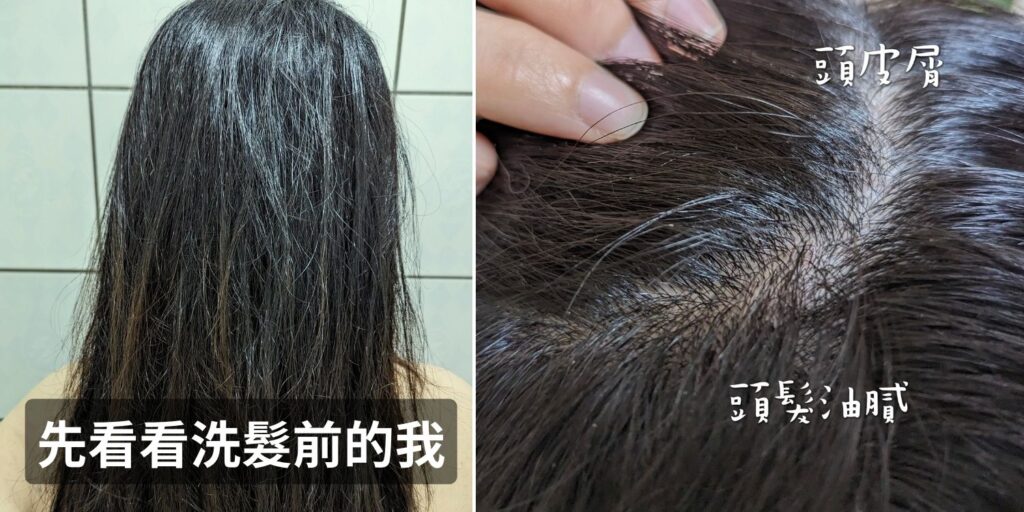 髮品開箱｜康定CONTIN｜你是油頭垢面一族嗎？你有頭皮屑、乾癢…等問題嗎？試試看這罐專為問題頭皮研發的酵素植萃洗髮乳吧