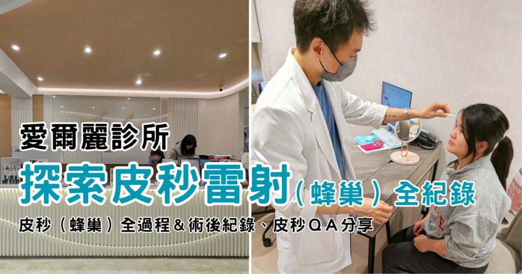 台北皮秒雷射心得｜探索皮秒雷射（蜂巢）全紀錄｜愛爾麗診所評價大公開！以及皮秒ＱＡ分享　－AG吃貨