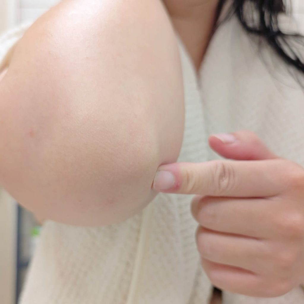 如果你跟我一樣，每到換季或長時間待在冷氣房，膝蓋、手肘、腳踝就會乾到發白甚至脫皮，那你一定要試試這個「Éternité乳液密集保濕小撇步」！  我會特別在這些「易粗糙部位」厚敷Éternité 永恆胜肽修護保濕乳液，用量不用客氣，厚厚一層塗好塗滿，靜待大約10分鐘。這時候可以搭配保鮮膜包覆住，讓乳液的滋養成分完整滲透進肌膚。  時間一到，用濕紙巾輕輕擦拭，真的會發現老廢角質悄悄剝落、肌膚變得柔嫩有彈性，連自己都想多摸幾下（笑）。 這招我每次換季或準備穿短褲、短裙前一定會用，是我的美肌小秘密武器。  Éternité 不只是臉部乳液，更是從頭到腳都能照顧的全方位保養神器，讓保濕修護不只停在表面，而是深入每一寸肌膚的貼心呵護。